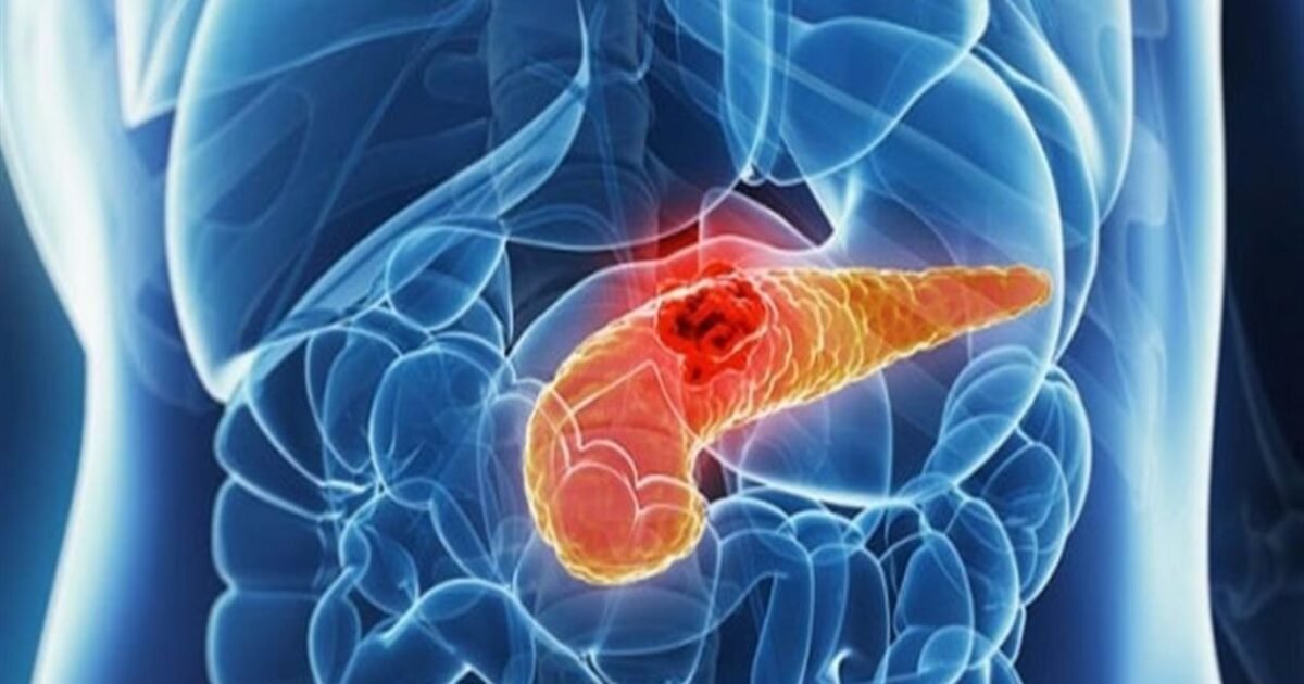 صورة مميزة: روش وإيلي ليلي يحصلان على موافقة أميركية لاختبار دم لمؤشرات ألزهايمر